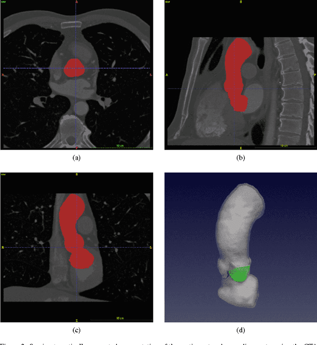 Figure 2 for Image-based immersed boundary model of the aortic root