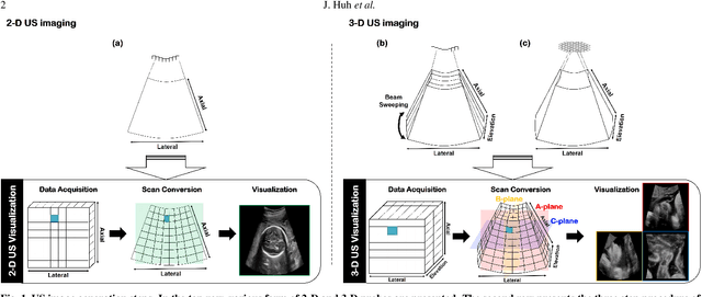 Figure 1 for Tunable Image Quality Control of 3-D Ultrasound using Switchable CycleGAN