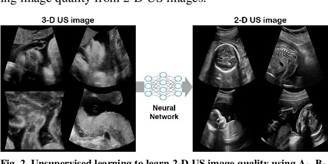 Figure 3 for Tunable Image Quality Control of 3-D Ultrasound using Switchable CycleGAN