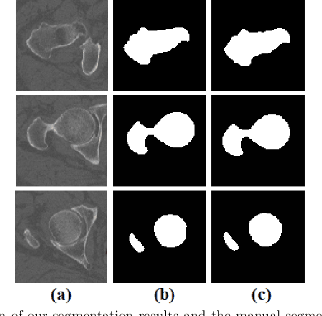 Figure 4 for Automated femur segmentation from computed tomography images using a deep neural network