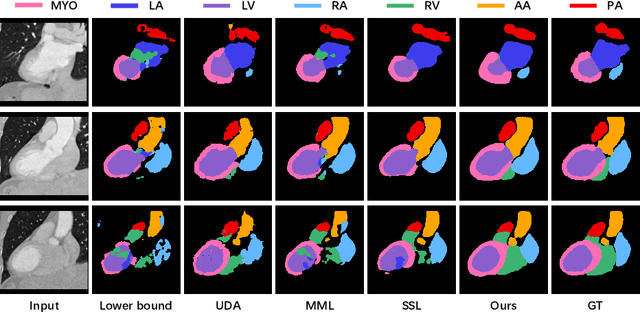 Figure 3 for Dual-Teacher: Integrating Intra-domain and Inter-domain Teachers for Annotation-efficient Cardiac Segmentation