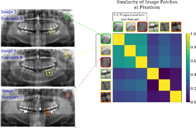 Figure 1 for Deep semantic gaze embedding and scanpath comparison for expertise classification during OPT viewing