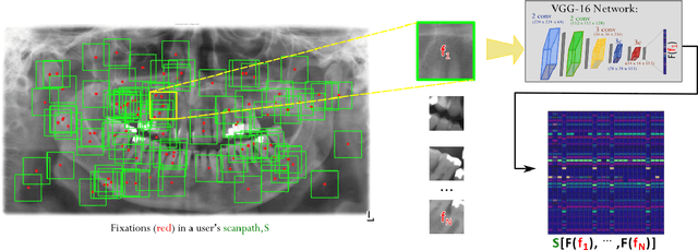 Figure 3 for Deep semantic gaze embedding and scanpath comparison for expertise classification during OPT viewing