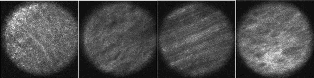 Figure 1 for Feasibility of Colon Cancer Detection in Confocal Laser Microscopy Images Using Convolution Neural Networks