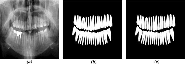 Figure 1 for Tooth Instance Segmentation on Panoramic Dental Radiographs Using U-Nets and Morphological Processing