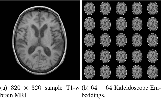 Figure 1 for Transformer Compressed Sensing via Global Image Tokens