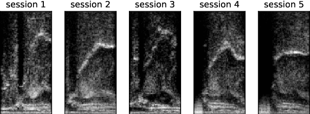 Figure 1 for Adaptation of Tacotron2-based Text-To-Speech for Articulatory-to-Acoustic Mapping using Ultrasound Tongue Imaging
