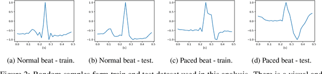 Figure 2 for Generating an Explainable ECG Beat Space With Variational Auto-Encoders