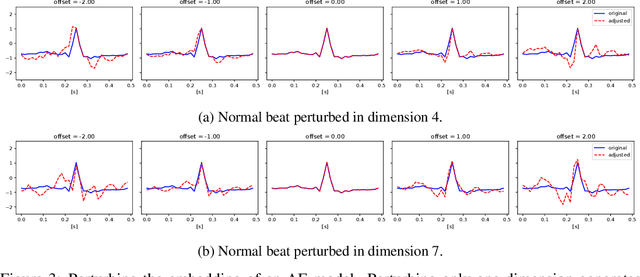 Figure 3 for Generating an Explainable ECG Beat Space With Variational Auto-Encoders
