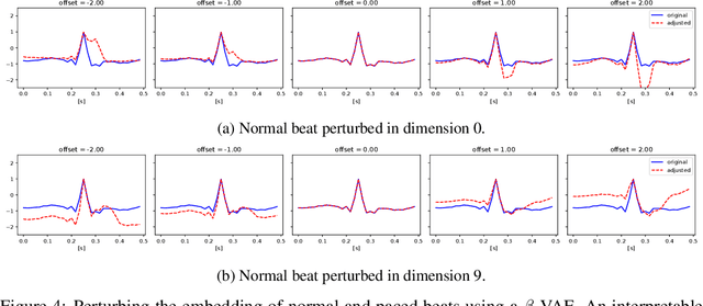Figure 4 for Generating an Explainable ECG Beat Space With Variational Auto-Encoders