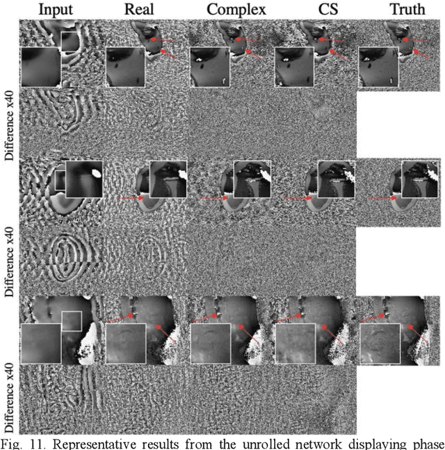 Figure 3 for Complex-Valued Convolutional Neural Networks for MRI Reconstruction