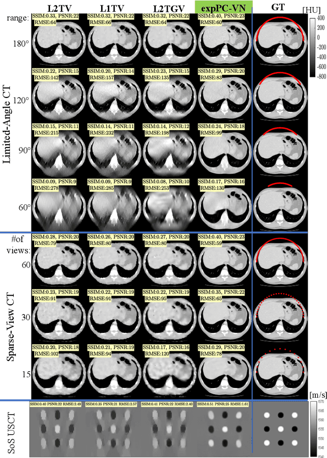 Figure 4 for Deep Variational Networks with Exponential Weighting for Learning Computed Tomography