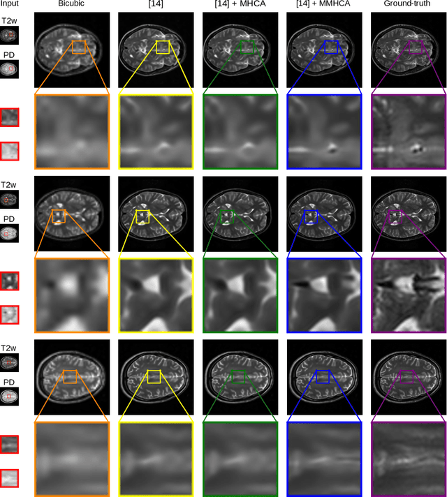 Figure 4 for Multimodal Multi-Head Convolutional Attention with Various Kernel Sizes for Medical Image Super-Resolution