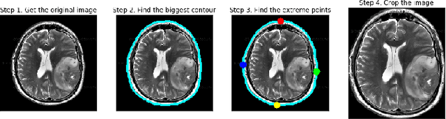 Figure 1 for Predictive modeling of brain tumor: A Deep learning approach