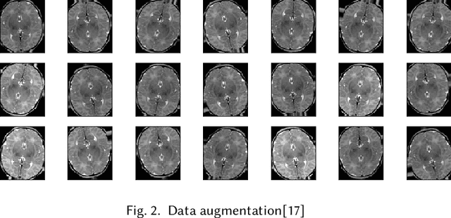 Figure 3 for Predictive modeling of brain tumor: A Deep learning approach