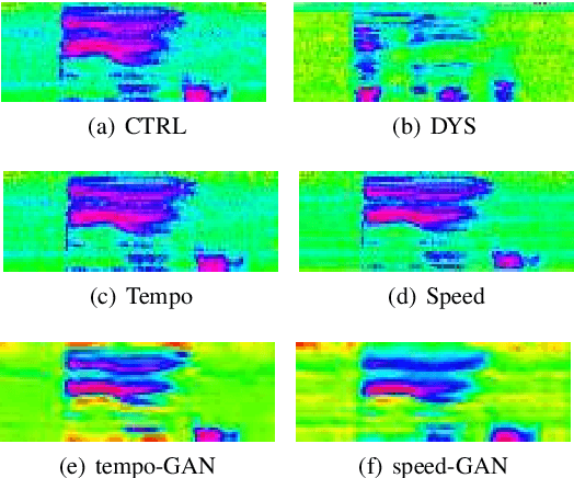 Figure 1 for Adversarial Data Augmentation for Disordered Speech Recognition