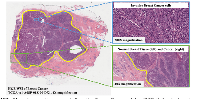 Figure 1 for AI and Pathology: Steering Treatment and Predicting Outcomes