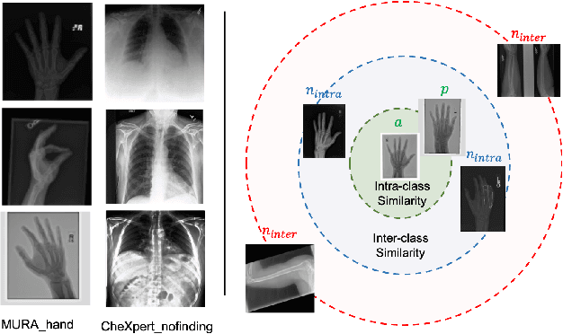 Figure 1 for OSCARS: An Outlier-Sensitive Content-Based Radiography Retrieval System