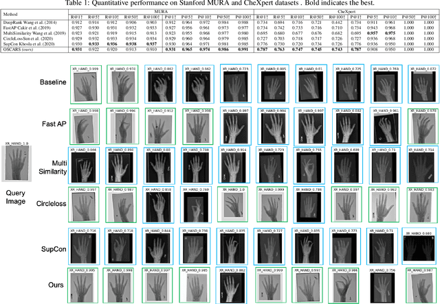 Figure 2 for OSCARS: An Outlier-Sensitive Content-Based Radiography Retrieval System