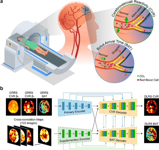 Figure 1 for Deep-learning-enabled Brain Hemodynamic Mapping Using Resting-state fMRI