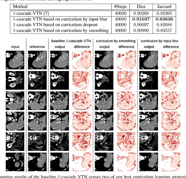 Figure 2 for Unsupervised Medical Image Alignment with Curriculum Learning
