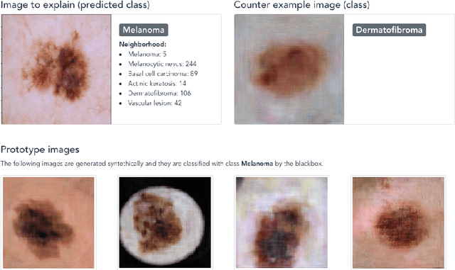 Figure 4 for Explainable Deep Image Classifiers for Skin Lesion Diagnosis