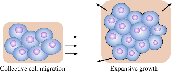 Figure 1 for Convolutional Invasion and Expansion Networks for Tumor Growth Prediction