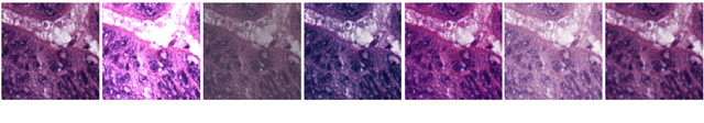 Figure 1 for Test Time Transform Prediction for Open Set Histopathological Image Recognition