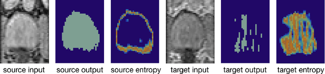 Figure 1 for Source-Relaxed Domain Adaptation for Image Segmentation