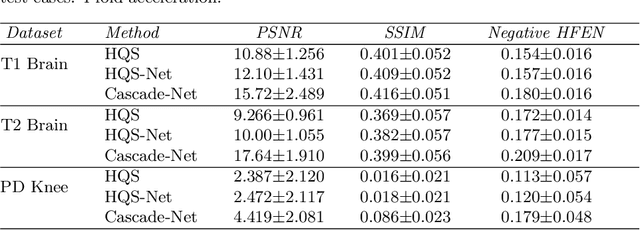 Figure 4 for Neural Network-based Reconstruction in Compressed Sensing MRI Without Fully-sampled Training Data