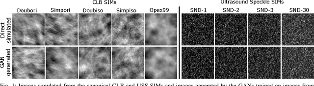 Figure 1 for Assessing the ability of generative adversarial networks to learn canonical medical image statistics