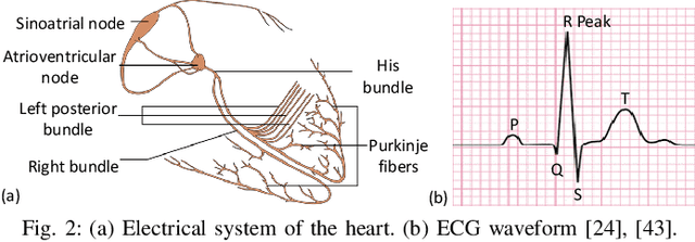 Figure 2 for LSTM-Based ECG Classification for Continuous Monitoring on Personal Wearable Devices
