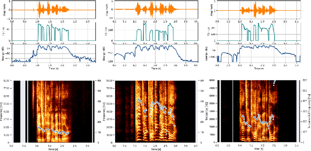 Figure 2 for Emotionless: Privacy-Preserving Speech Analysis for Voice Assistants