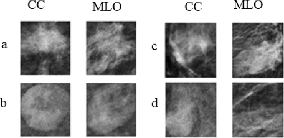 Figure 2 for Mammography Dual View Mass Correspondence