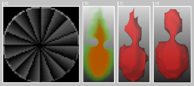 Figure 3 for 2.5D Thermometry Maps for MRI-guided Tumor Ablation