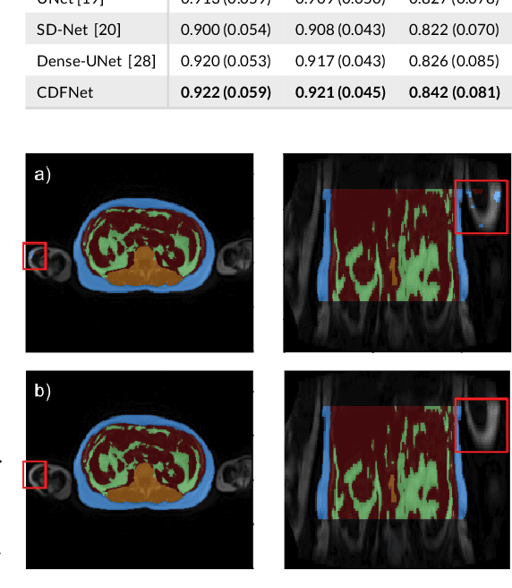 Figure 2 for FatSegNet : A Fully Automated Deep Learning Pipeline for Adipose Tissue Segmentation on Abdominal Dixon MRI