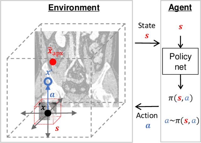 Figure 2 for Reinforcement Learning-based Automatic Diagnosis of Acute Appendicitis in Abdominal CT