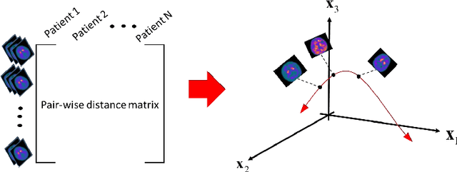 Figure 3 for Dopamine Transporter SPECT Image Classification for Neurodegenerative Parkinsonism via Diffusion Maps and Machine Learning Classifiers