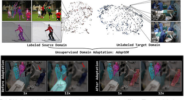 Figure 1 for Unsupervised domain adaptation for clinician pose estimation and instance segmentation in the OR