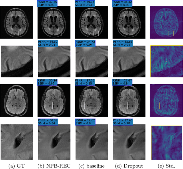 Figure 4 for NPB-REC: Non-parametric Assessment of Uncertainty in Deep-learning-based MRI Reconstruction from Undersampled Data