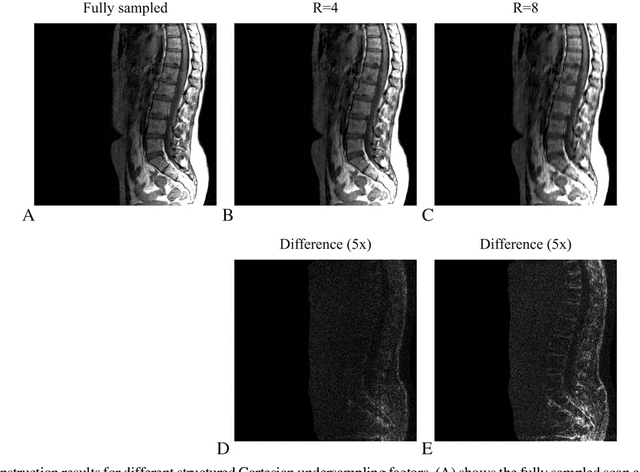 Figure 3 for Accelerating CS in Parallel Imaging Reconstructions Using an Efficient and Effective Circulant Preconditioner