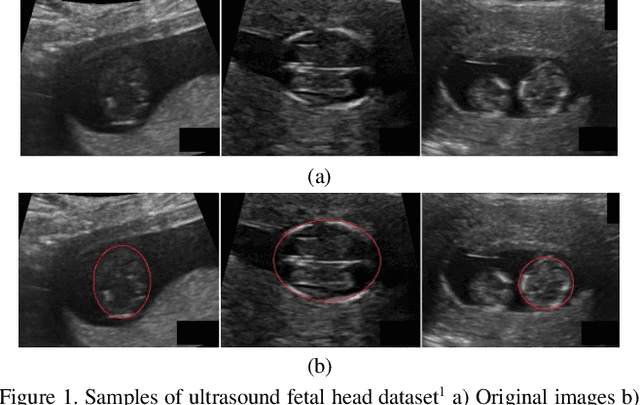 Figure 1 for Fetal Ultrasound Image Segmentation for Measuring Biometric Parameters Using Multi-Task Deep Learning