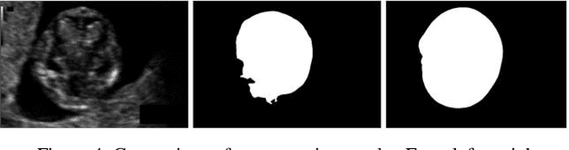 Figure 4 for Fetal Ultrasound Image Segmentation for Measuring Biometric Parameters Using Multi-Task Deep Learning