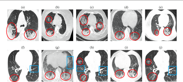 Figure 4 for Radiologist-Level COVID-19 Detection Using CT Scans with Detail-Oriented Capsule Networks