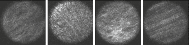 Figure 4 for Deep Transfer Learning Methods for Colon Cancer Classification in Confocal Laser Microscopy Images