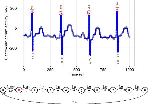 Figure 4 for A Greedy Graph Search Algorithm Based on Changepoint Analysis for Automatic QRS Complex Detection