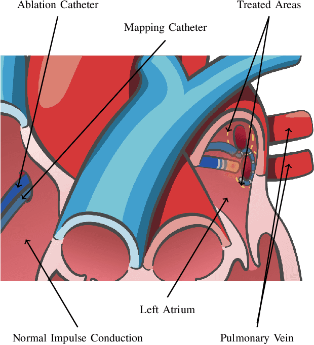 Figure 1 for Roughly Collected Dataset for Contact Force Sensing Catheter