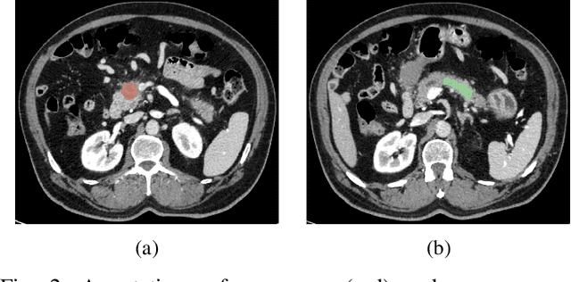 Figure 2 for CEC-CNN: A Consecutive Expansion-Contraction Convolutional Network for Very Small Resolution Medical Image Classification