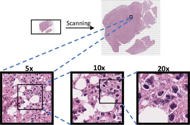 Figure 1 for A Morphology Focused Diffusion Probabilistic Model for Synthesis of Histopathology Images