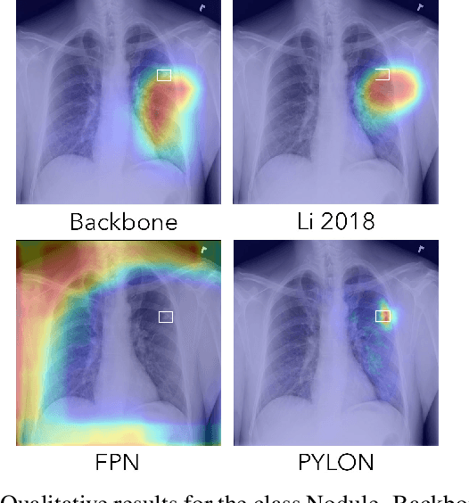 Figure 3 for High resolution weakly supervised localization architectures for medical images